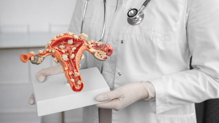 Обложка статьи о питании при эндометриозе