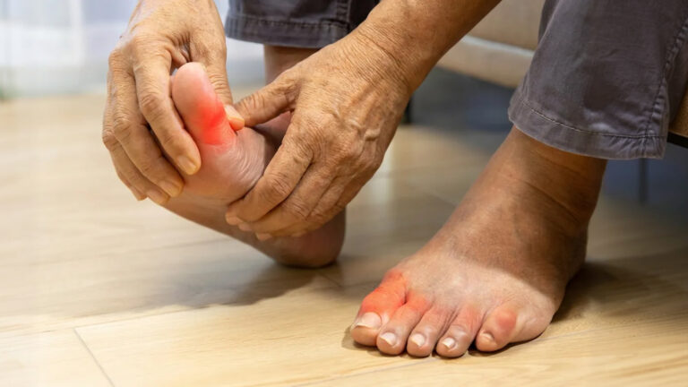 Обложка статьи о подагре